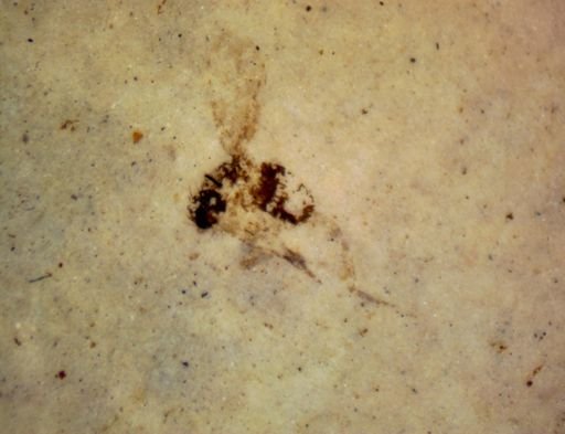 undet. Hexapoda