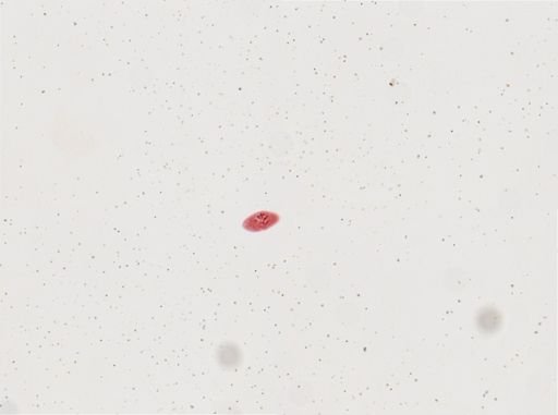 Paramecium calkinsi