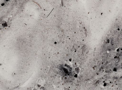 Iodamoeba butschlii