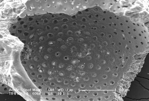 Neogloboquadrina dutertrei