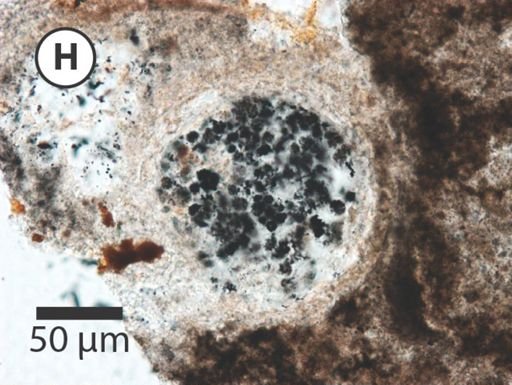 Megasphaera miniscula