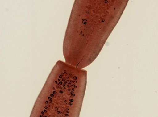 Dipylidium caninum