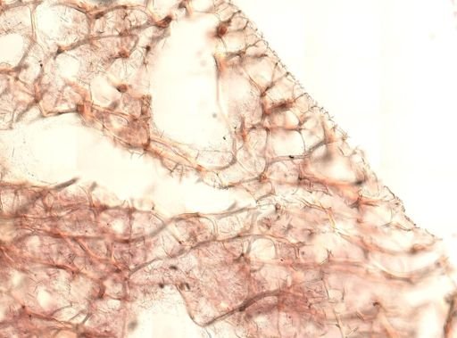 Callyspongia vaginalis