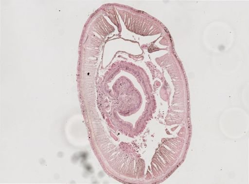Oligochaeta