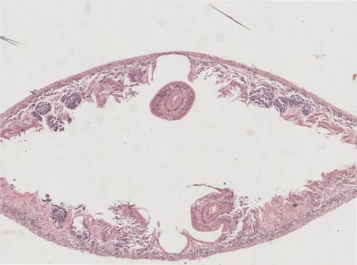 Phagocata gracilis