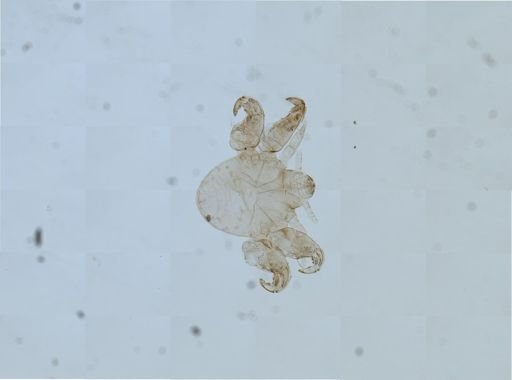 Pthirus pubis