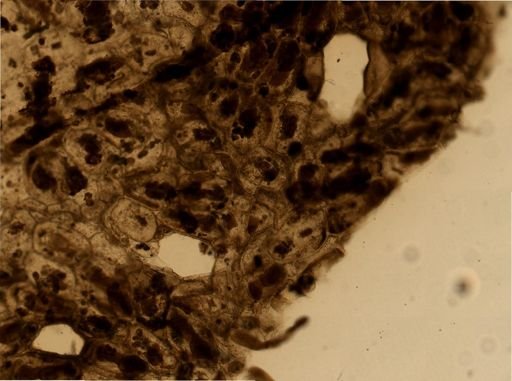 Alcyonidium