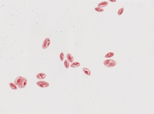Paramecium calkinsi