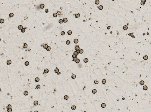 Taenia solium