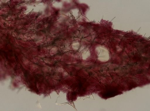 Axinellidae