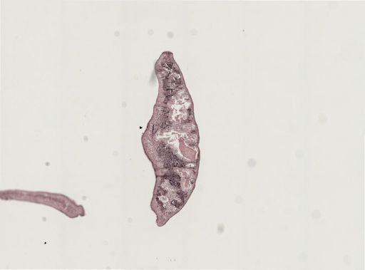 Foviella