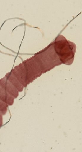 Dipylidium caninum