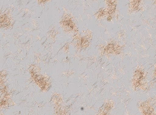 Plakortis sp.