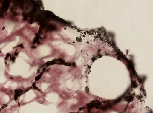 Ircinia