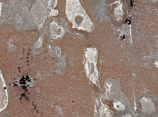 Taenia crassicollis