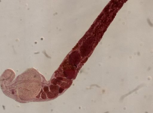 Gorgoderina