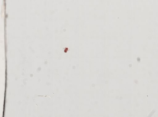 Trematoda