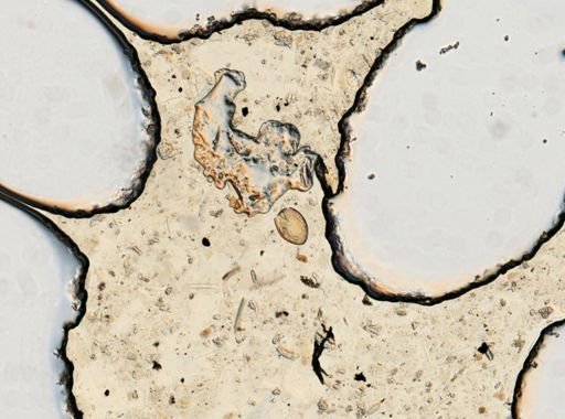 Paragonimus westermani