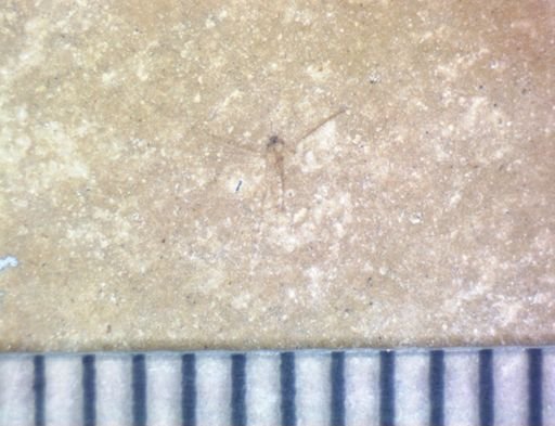 undet. Hexapoda