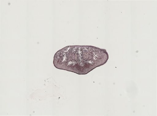 Foviella