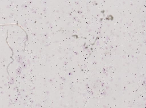 Toxoplasma