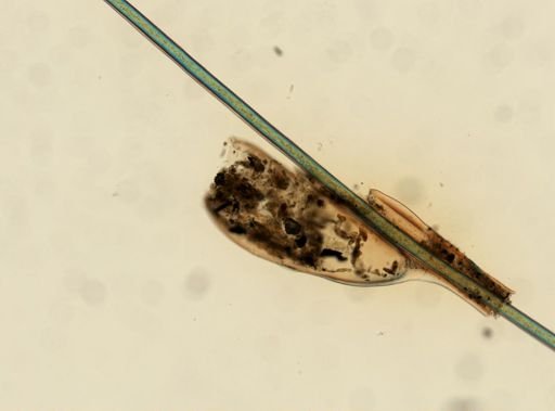Pediculus humanus