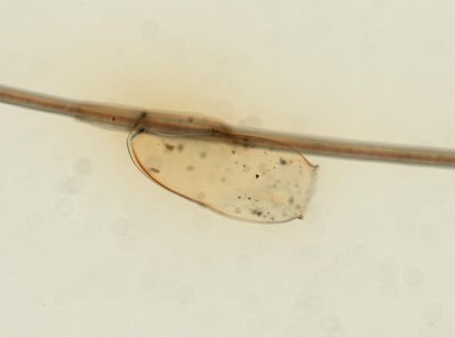 Pediculus humanus