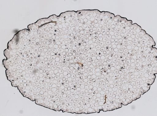Ascaris megalocephala
