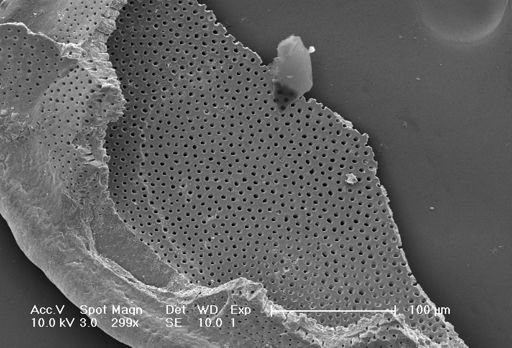 Globorotalia menardii