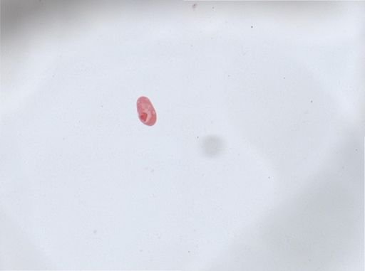 Paramecium aurelia