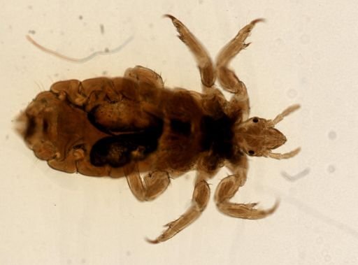 Pediculus humanus