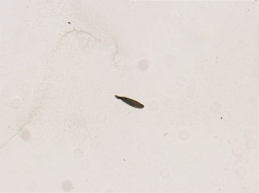 Opalina ranarum