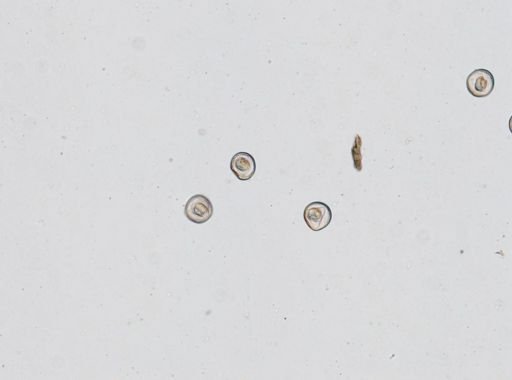 Hymenolepis diminuta