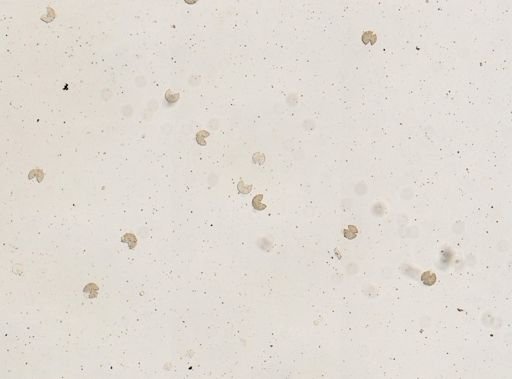 Taenia saginata