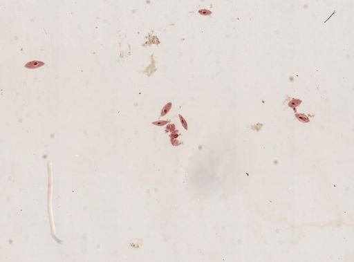 Paramecium
