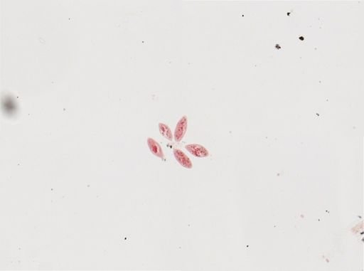 Paramecium calkinsi
