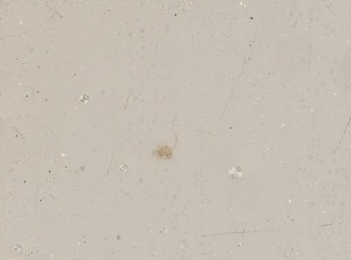 Brachionus leydigii