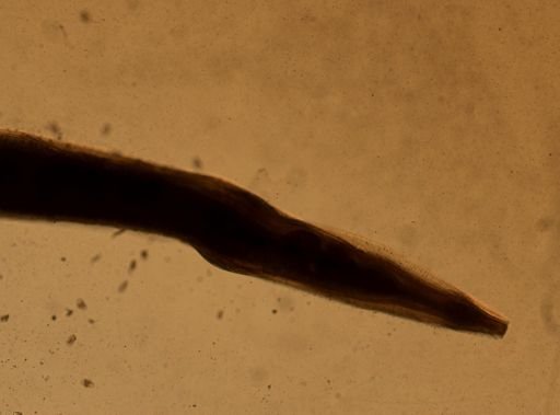 Enterobius vermicularis