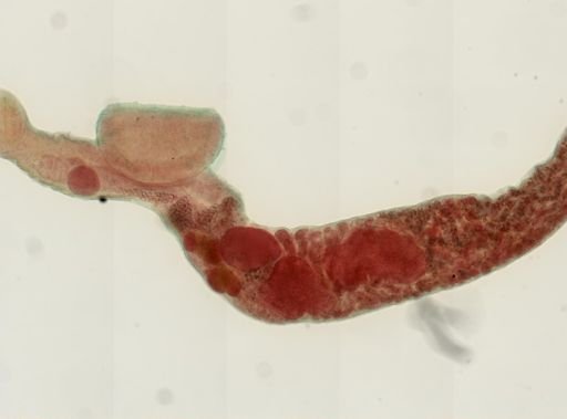 Gorgoderina attenuata