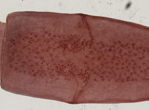 Dipylidium caninum