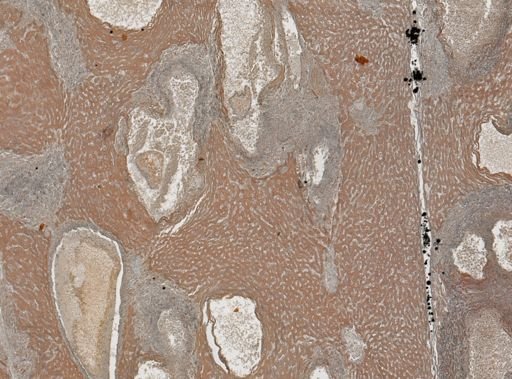 Taenia crassicollis