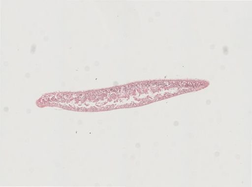 Phagocata gracilis