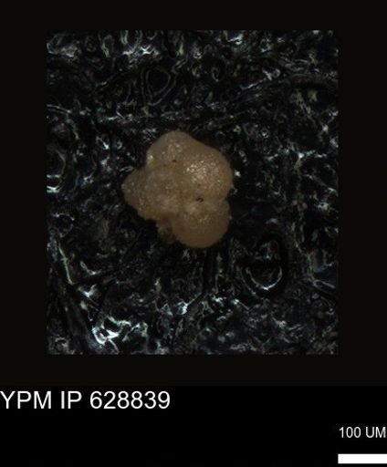 undet. Foraminiferida