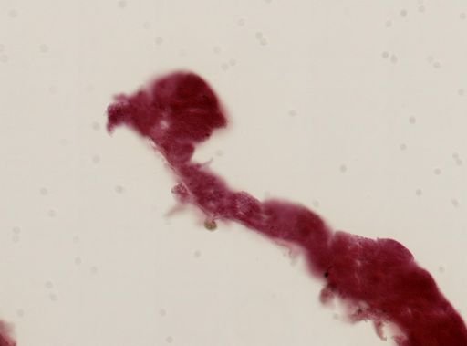 Halisarca sp.