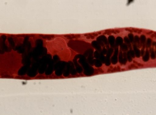 Platyhelminthes