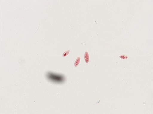 Paramecium calkinsi
