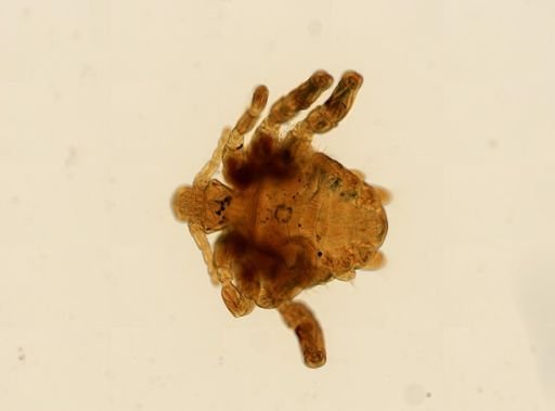 Pthirus pubis
