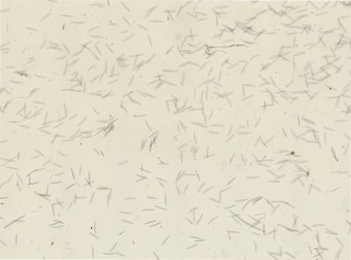 Haliclona oculata