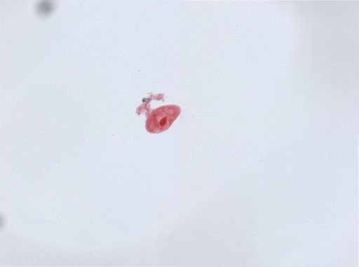 Paramecium aurelia