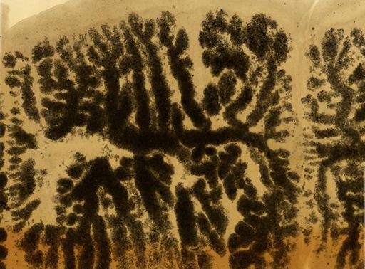 Taenia solium